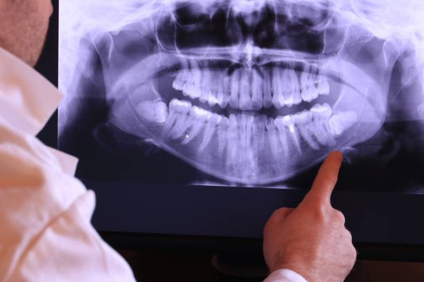 Best Emergency Broken Tooth Repair in Springerville, AZ