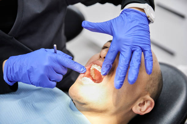 Best Emergency Wisdom Teeth Removal in Springerville, AZ